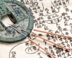 akupunkturnadeln aufliegend auf metallener scheibe