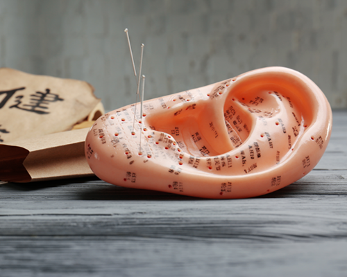 ohrmodell mit akupunkturpunkten und nadeln