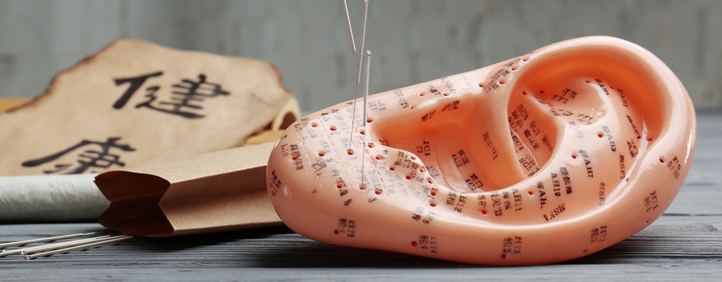 Modell eines Ohres mit markierten Akupunkturpunkten und gesetzten Nadeln zur Veranschaulichung der Ohrakupunktur in einer Heilpraktikerpraxis